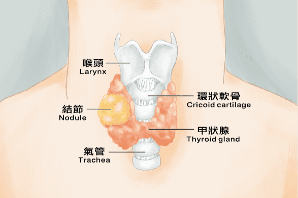紅光療法促進甲狀腺健康和平衡