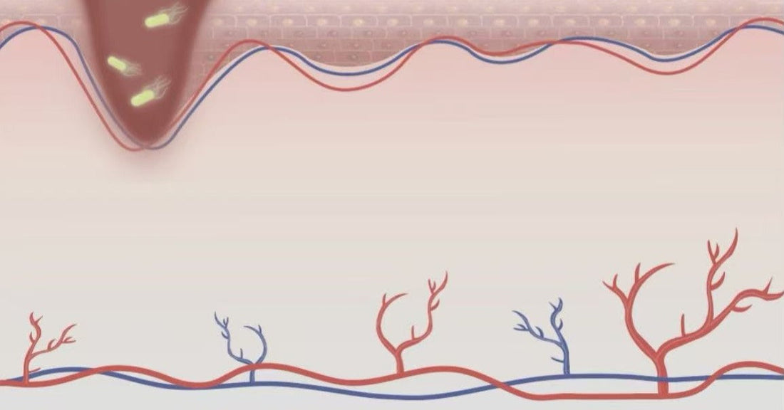 紅光療法對開放性傷口的影響